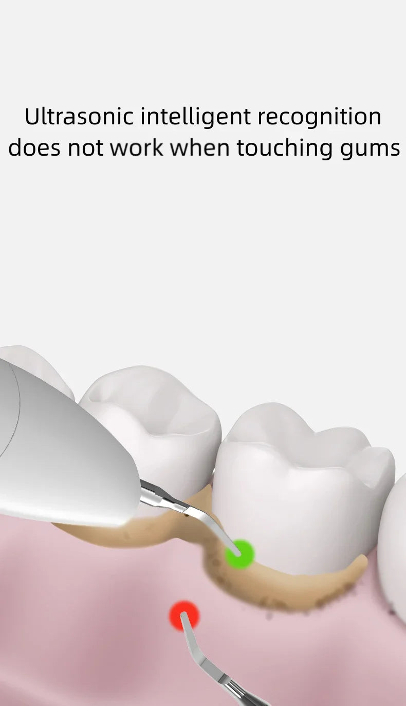 UltraClean Smile Kit